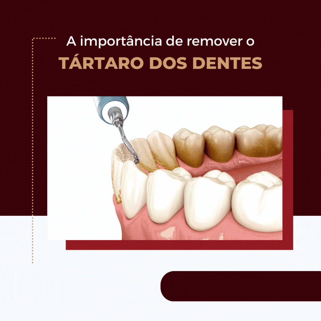 Post do instagram sobre botox facial minimalista em cinza